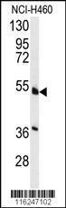 Anti-HNF4A Rabbit Polyclonal Antibody (APC (Allophycocyanin))