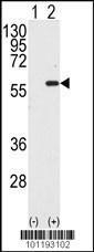 Anti-MST1 Rabbit Polyclonal Antibody (HRP (Horseradish Peroxidase))