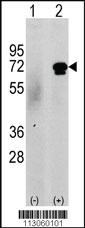 Anti-CAMKK2 Rabbit Polyclonal Antibody