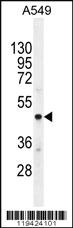 Anti-CMGA Rabbit Polyclonal Antibody