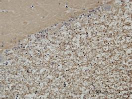 Anti-STXBP1 Mouse Monoclonal Antibody [clone: 6D1]