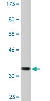 Anti-MED31 Mouse Monoclonal Antibody [clone: 2C8]