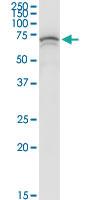 Anti-HSPA1A Polyclonal Antibody Pair