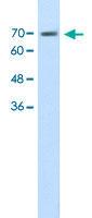 Anti-EPS8L1 Rabbit Polyclonal Antibody