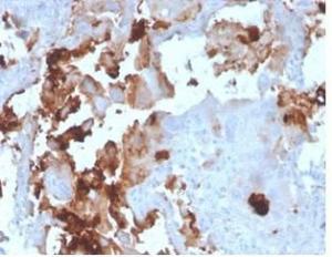 Anti-L-PLUNC antibody