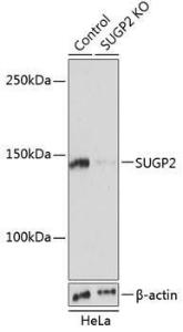 Western blot analysis of extracts from normal (control) and SUGP2 knockout (KO) HeLa cells, using Anti-SFRS14 / SUGP2 Antibody (A305678) at 1:1,000 dilution. The secondary antibody was Goat Anti-Rabbit IgG H&L Antibody (HRP) at 1:10,000 dilution.