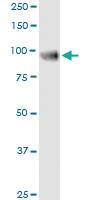 Anti-RECK Polyclonal Antibody Pair