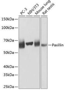 Anti-Paxillin Rabbit Monoclonal Antibody [clone: ARC0368]