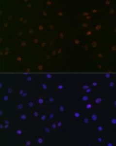 Immunofluorescence analysis of C6 cells using Anti-SPT5 Antibody [ARC2380] (A308173) at a dilution of 1:100 (40X lens). DAPI was used to stain the cell nuclei (blue)