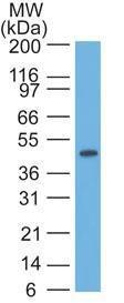 Western blot analysis of HeLa cell lysate using Anti-Cytokeratin 17 Antibody [E3]