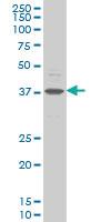 Anti-CHST11 Mouse Monoclonal Antibody [clone: 4F1]