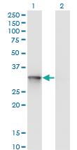 Anti-UBE2Q2 Mouse Monoclonal Antibody [clone: 5E7]