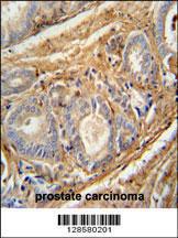 Anti-C1QTNF9B-AS1 Rabbit Polyclonal Antibody (PE (Phycoerythrin))