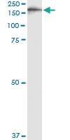 Anti-IQGAP3 Antibody Pair