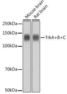 Western blot analysis of extracts of various cell lines, using Anti-TrkA +TRkB + TrkC Antibody [ARC2649] (A309687) at 1:1,000 dilution. The secondary antibody was Goat Anti-Rabbit IgG H&L Antibody (HRP) at 1:10,000 dilution.