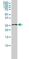 Anti-RASL11B Mouse Monoclonal Antibody [clone: 1B5]