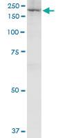 Anti-IQGAP3 Polyclonal Antibody Pair