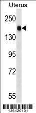 Anti-CGNL1 Rabbit Polyclonal Antibody (HRP (Horseradish Peroxidase))