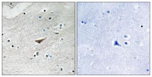 Immunohistochemical analysis of paraffin-embedded human brain using Anti-VE-Cadherin (phospho Tyr731) Antibody. The right hand panel represents a negative control, where the antibody was pre-incubated with the immunising peptide.