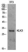 Anti-Prostate Specific Antigen Rabbit Polyclonal Antibody