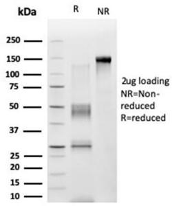 SDS-PAGE analysis of Anti-ZNF276 Antibody [PCRP-ZNF276-1A5] under non-reduced and reduced conditions; showing intact IgG and intact heavy and light chains, respectively SDS-PAGE analysis confirms the integrity and purity of the antibody