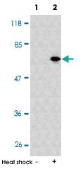 Anti-PRKAA1 Rabbit Polyclonal Antibody