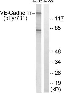 Western blot analysis of lysates from HepG2 cells treated with Na3VO4 0.3mM 40' using Anti-VE-Cadherin (phospho Tyr731) Antibody. The right hand lane represents a negative control, where the antibody is blocked by the immunising peptide.