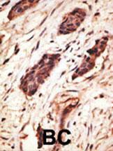 Anti-MMP10 Rabbit Polyclonal Antibody (AP (Alkaline Phosphatase))