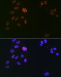 Immunofluorescence analysis of U2OS cells using Anti-SPT5 Antibody [ARC2380] (A308173) at a dilution of 1:100 (40X lens). DAPI was used to stain the cell nuclei (blue)