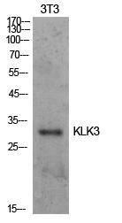 Anti-Prostate Specific Antigen Rabbit Polyclonal Antibody