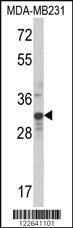 Anti-MLX Rabbit Polyclonal Antibody