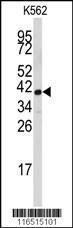 Anti-FBL Rabbit polyclonal antibody