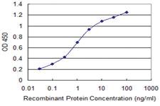 Anti-RABGAP1 Mouse Monoclonal Antibody [clone: 3D11]