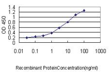 Anti-UBE2Q2 Mouse Monoclonal Antibody [clone: 5E7]