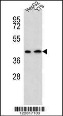 Anti-AADAT Rabbit Polyclonal Antibody (HRP (Horseradish Peroxidase))