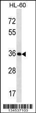 Anti-KLK9 Rabbit Polyclonal Antibody (FITC (Fluorescein Isothiocyanate))