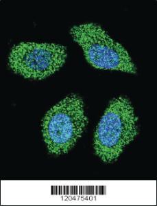 Anti-ENTPD3 Rabbit Polyclonal Antibody