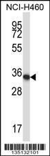 Anti-HOXA11 Rabbit Polyclonal Antibody (FITC (Fluorescein Isothiocyanate))