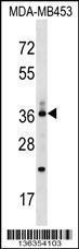 Anti-CD68 Rabbit Polyclonal Antibody