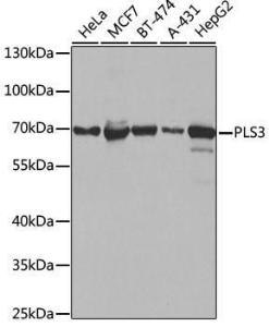 Western blot analysis of extracts of various cell lines, using Anti-T Plastin / PLS3 Antibody (A307123) at 1:1000 dilution