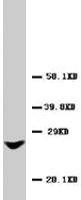 Anti-GJB2 Rabbit Polyclonal Antibody