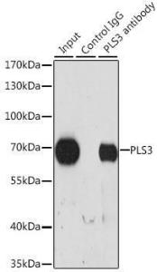 Immunoprecipitation analysis of 200 µg extracts of HeLa cells using 3 µg of Anti-T Plastin / PLS3 Antibody (A307123). This Western blot was performed on the immunoprecipitate using Anti-T Plastin / PLS3 Antibody (A307123) at a dilution of 1:1000