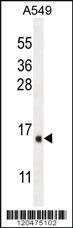 Anti-ENTPD3 Rabbit Polyclonal Antibody