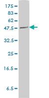 Anti-PLTP Mouse Monoclonal Antibody [clone: 2F3-G4]