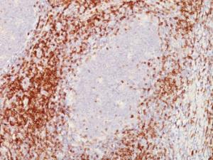 Immunohistochemical analysis of formalin-fixed, paraffin-embedded human tonsil using Anti-CD5 Antibody [C5/473 + CD5/54/F6]