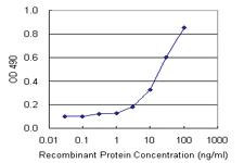 Anti-MCM4 Polyclonal Antibody Pair