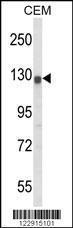 Anti-HERG1 Rabbit Polyclonal Antibody (AP (Alkaline Phosphatase))