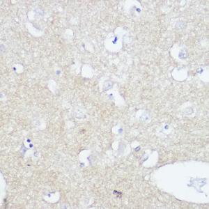 Immunohistochemistry analysis of paraffin-embedded human brain tissue using Anti-TrkA +TRkB + TrkC Antibody [ARC2649] (A309687) at a dilution of 1:100 (40x lens). Perform high pressure antigen retrieval with 10 mM citrate buffer pH 6.0 before commencing with IHC staining protocol.