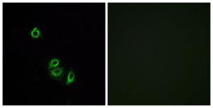 Immunofluorescence analysis of A549 cells using Anti-OR2L5 Antibody The right hand panel represents a negative control, where the antibody was pre-incubated with the immunising peptide