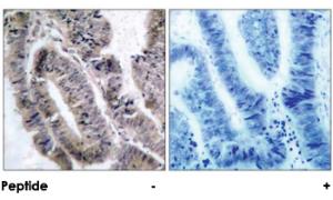 Anti-PRKAA1 Rabbit Polyclonal Antibody